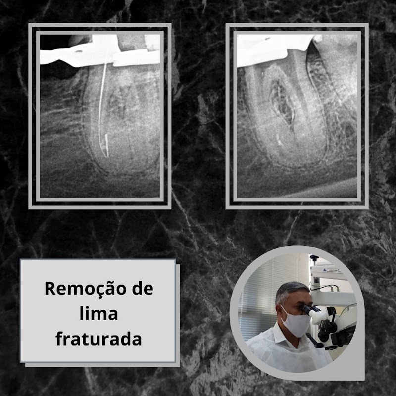 Dr. Claudio Roberto Moreira - Endodontia com Microscopia - foto 3