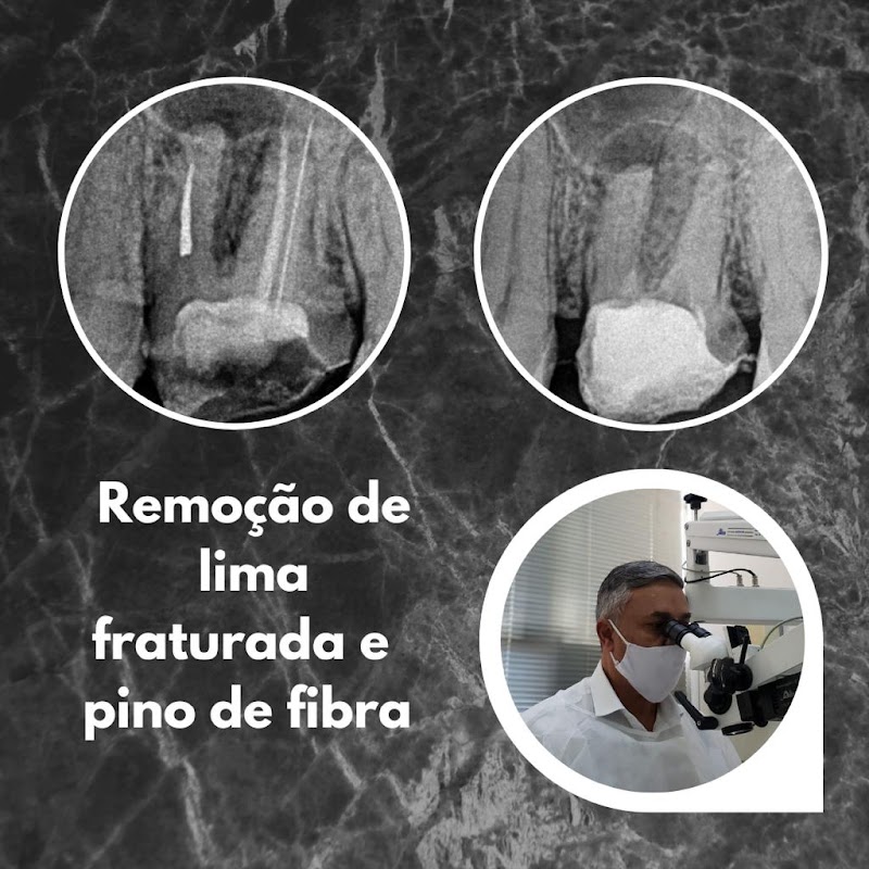 Dr. Claudio Roberto Moreira - Endodontia com Microscopia - foto 4