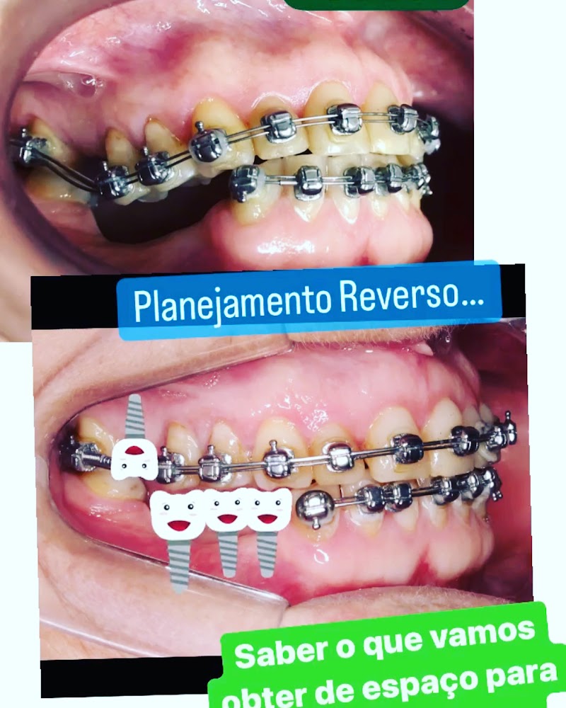 Lagos Dente implante dentário Macae - foto 4