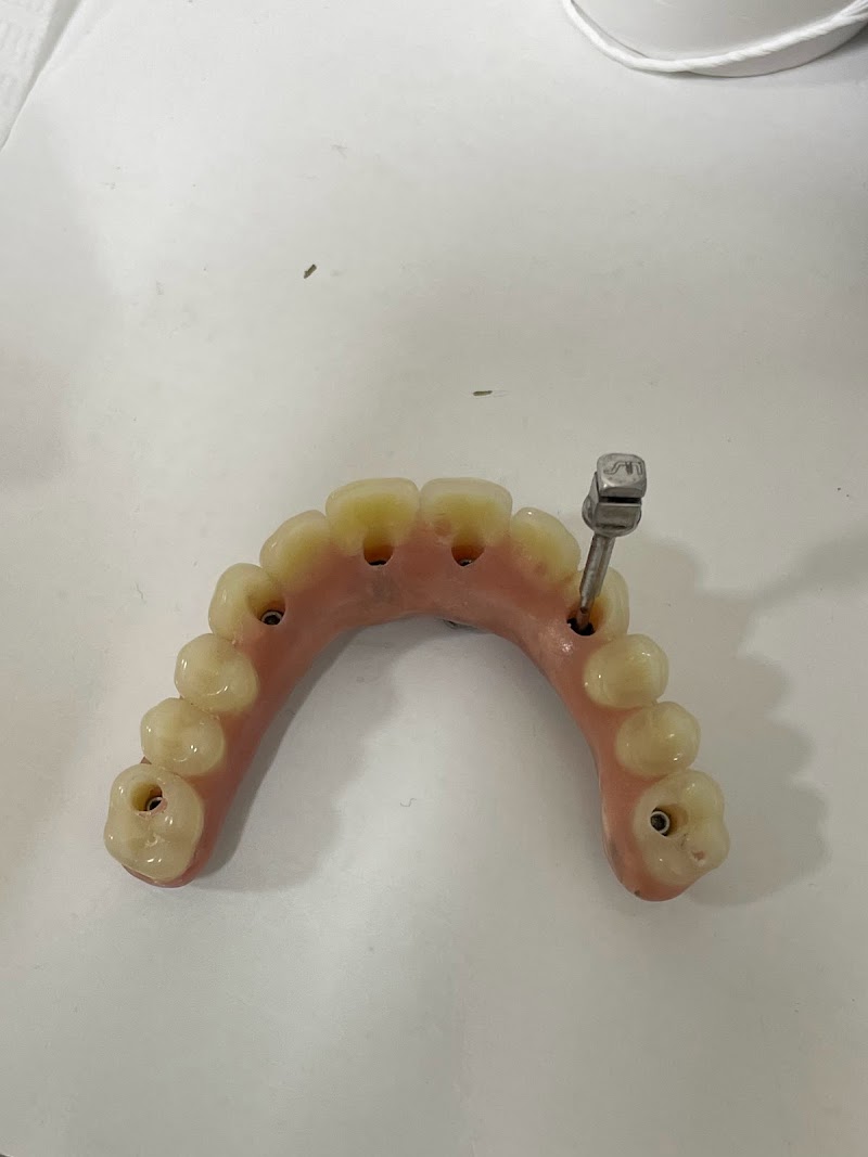 Lagos Dente implante dentário Macae - foto 5