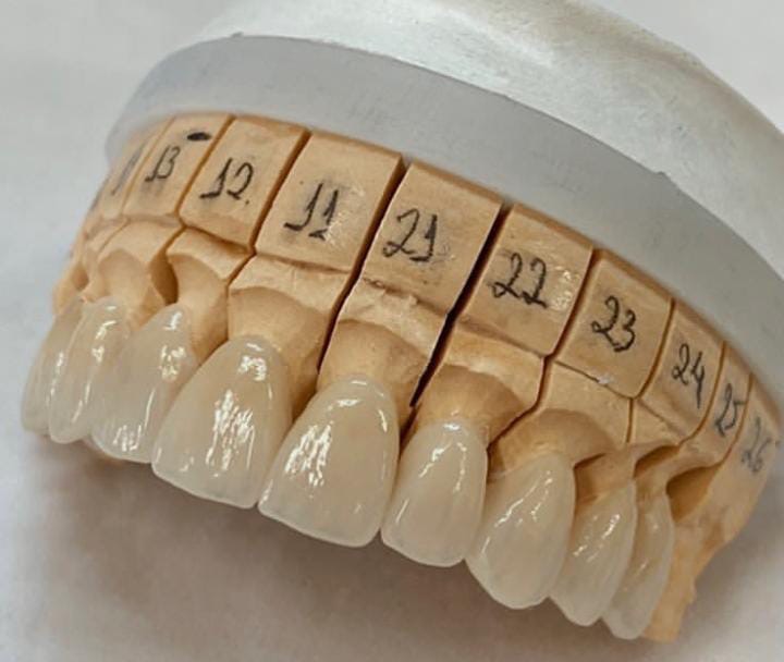 Dentista 24h - Centro SP - Urgências - Dr. Bruno Frison - CROSP 128.512 - foto 3