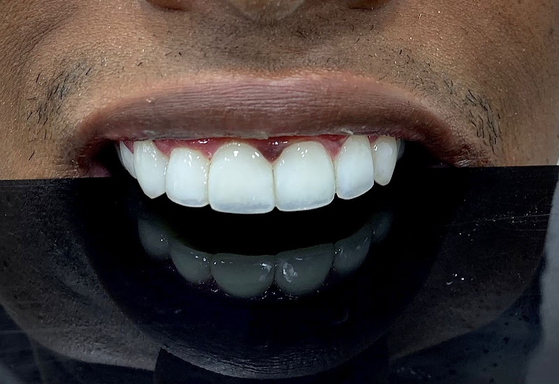 Dentista 24h - Centro SP - Urgências - Dr. Bruno Frison - CROSP 128.512 - foto 4