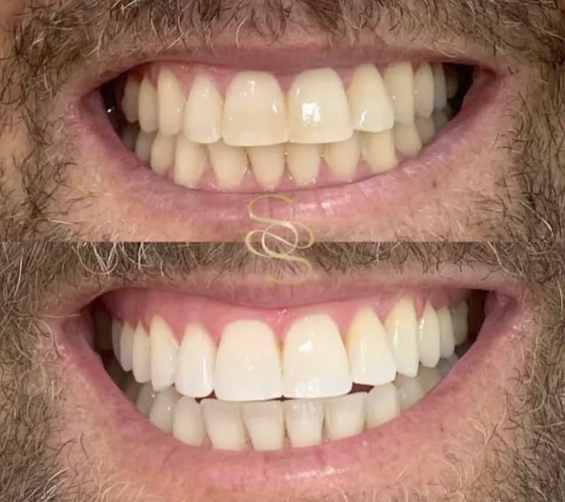 Sousa Fortes Odontologia | Implante Dentário | Facetas de Resina I HOF - foto 3