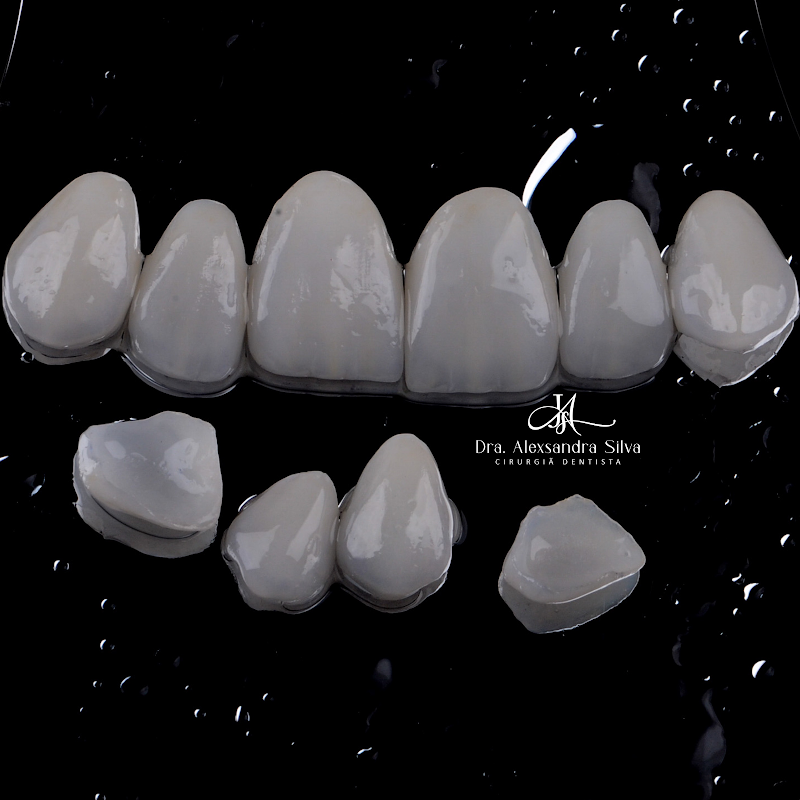 Dra. Alexsandra Silva | Dentista na Bela Vista - foto 5