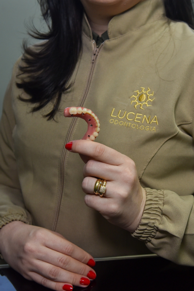 LUCENA Odontologia - Prótese Protocolo e Implante em Teresina - Lente de contato dental em Teresina - foto 1