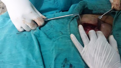 Breast Surgery Lady Doctor Dr Ramabai in Anantapur