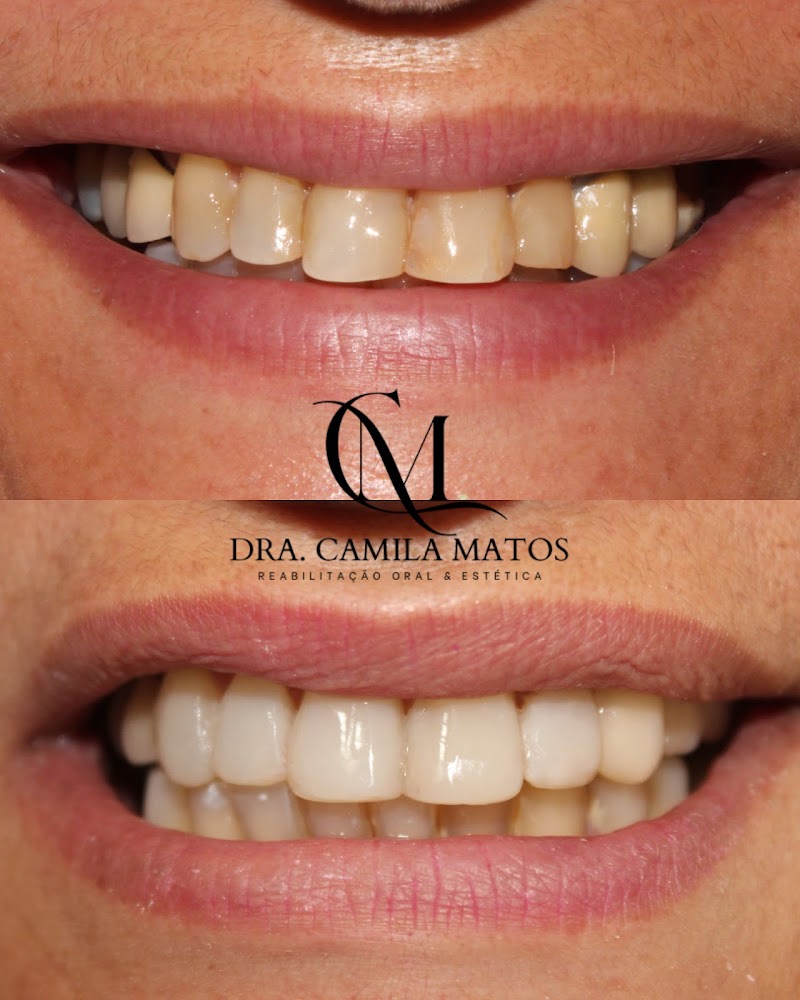Dra. Camila Matos Reabilitação Oral & Estética - foto 4