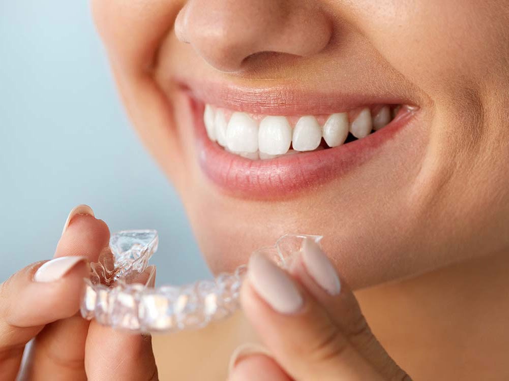 Dr. Michael's Dental Clinic - Micris Branch 4