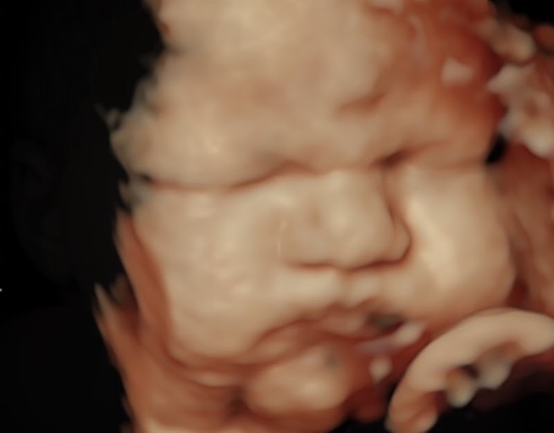 3D/4D Mother Goose Imaging Center