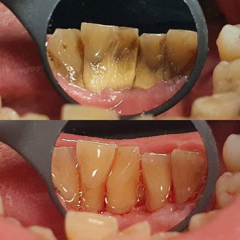 Dentista 24 horas em João Pessoa - Dra.Lanna Lídia - foto 3